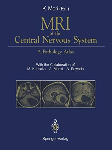 MRI of the Central Nervous System A Pathology Atlas