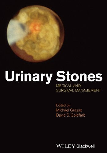 Urinary Stones Medical and Surgical Management