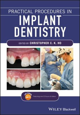 Practical Procedures in Implant Dentistry