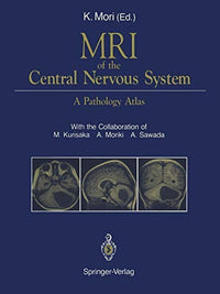 MRI of the Central Nervous System A Pathology Atlas