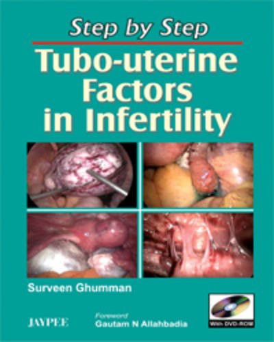 Tubo-Uterine Factors in Infertility