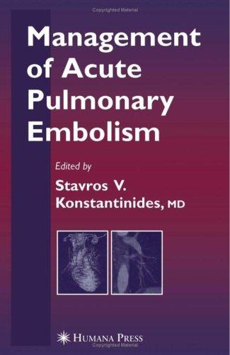 Management of Acute Pulmonary Embolism