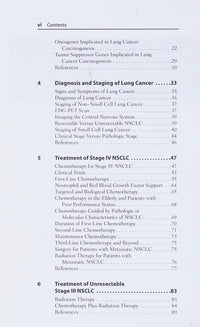 Dx/Rx: Lung Cancer