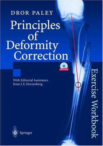 Principles of Deformity Correction Exercise Workbook